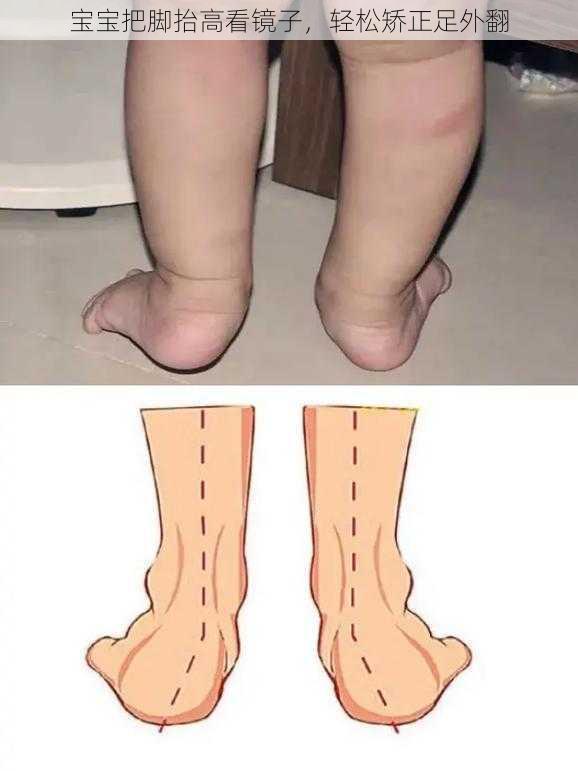宝宝把脚抬高看镜子,轻松矫正足外翻