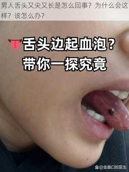 男人舌头又尖又长是怎么回事？为什么会这样？该怎么办？